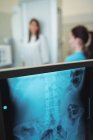 Крупный план рентгеновского монитора в больнице — стоковое фото