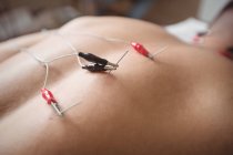 Close-up de paciente recebendo agulha electro seco de volta na clínica — Fotografia de Stock
