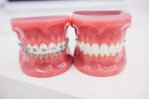 Primo piano dei modelli di denti nella clinica dentale — Foto stock