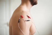 Primer plano del paciente masculino recibiendo agujas electro secas en el hombro - foto de stock