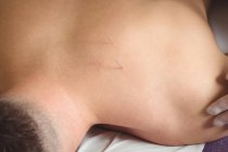 Close-up of patient getting dry needling on shoulder — Stock Photo
