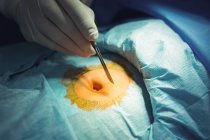 Chirurgien avec scalpel opérant en salle d'opération à l'hôpital — Photo de stock