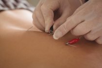Nahaufnahme des Physiotherapeuten bei der Durchführung elektrotrockener Nadelstiche auf dem Rücken eines Patienten in der Klinik — Stockfoto