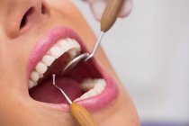 Крупный план стоматолога, осматривающего женские зубы пациента — стоковое фото