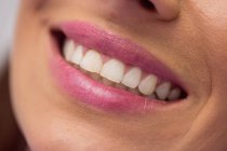 Gros plan de la bouche et des dents souriantes de la femme — Photo de stock