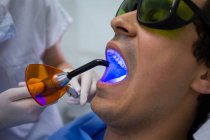 Dentista examinando os dentes do paciente com luz de cura dentária na clínica, close-up — Fotografia de Stock