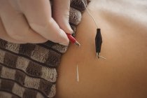 Fisioterapeuta realizando agujas electro-secas en la cintura del paciente - foto de stock