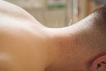 Gros plan du patient masculin qui se sèche à l'aiguille sur le cou — Photo de stock