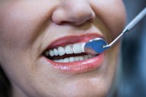Крупный план зубов пациента осматривается с помощью зеркала угла в стоматологической клинике — стоковое фото