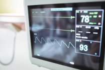 Close-up of vital signs monitor in hospital — Stock Photo