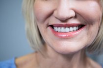 Primo piano di denti bianchi di donna sorridente — Foto stock