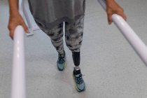 Низька частина жіночого ампутаційного пацієнта, що ходить з паралельними смугами в лікарні — стокове фото