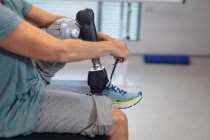 Unterteil einer Patientin mit Beinprothese, die Schnürsenkel im Krankenhaus bindet — Stockfoto