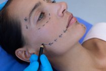 Nahaufnahme eines männlichen Chirurgen, der das schöne Gesicht einer kaukasischen Frau vor einer plastischen Operation im Krankenhaus markiert — Stockfoto