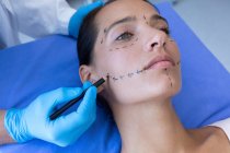 Nahaufnahme eines männlichen Chirurgen, der das Gesicht einer hübschen kaukasischen Frau vor einer plastischen Operation im Krankenhaus markiert — Stockfoto