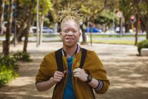 Retrato de um homem americano albino-africano sorridente com dreadlocks a olhar para a câmara. em movimento, fora e em torno da cidade. — Fotografia de Stock