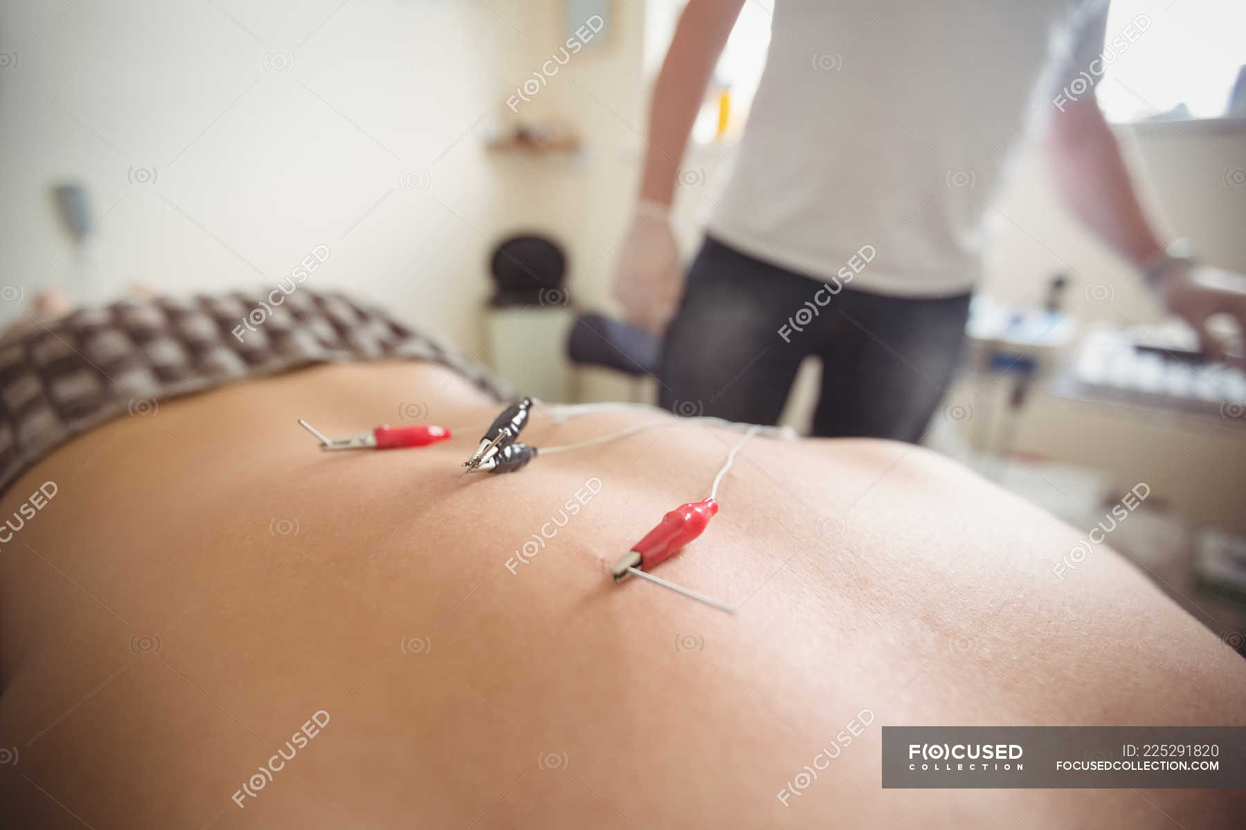 Cbt Needles