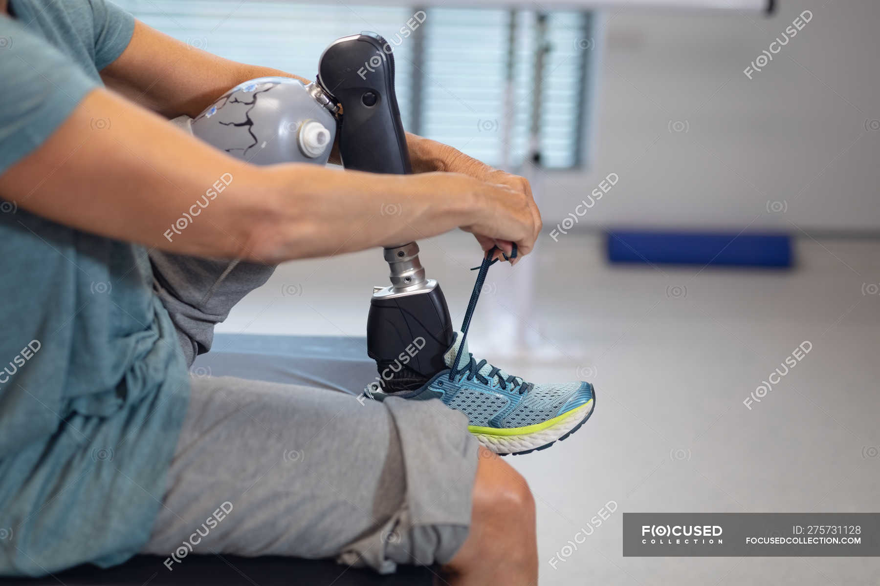 Baixa secção de paciente do sexo feminino com prótese perna amarrando