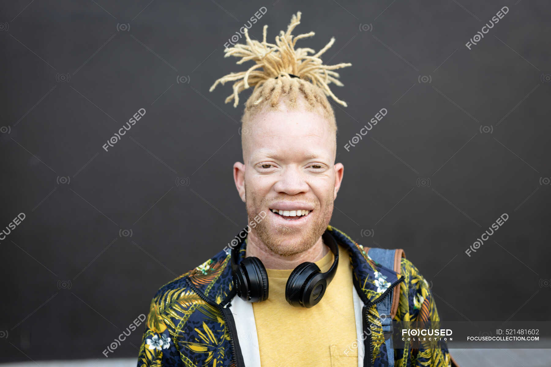 Portrait of albino african american man with dreadlocks looking at ...