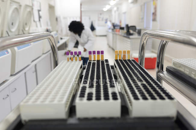 Лабораторний технік, що аналізує мішок крові в банку крові — стокове фото