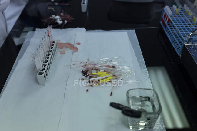 Primer plano del tubo de ensayo en el estante del banco de sangre - foto de stock