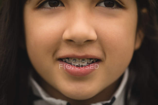 Close-up de menina em aparelho sorrindo — Fotografia de Stock