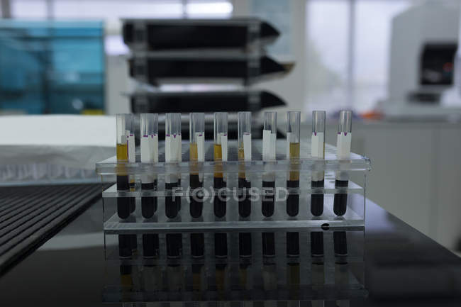 Close-up de tubo de ensaio em rack no banco de sangue — Fotografia de Stock