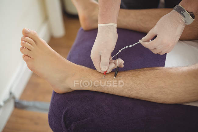 Primer plano del fisioterapeuta realizando agujas electrosecas en la pierna de un paciente en la clínica - foto de stock