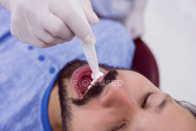 Nahaufnahme des Patienten mit offenem Mund, der sich in der Zahnklinik einer zahnärztlichen Untersuchung unterzieht — Stockfoto