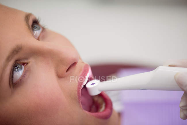 Primer plano del paciente con boca abierta sometido a chequeo dental en clínica dental - foto de stock