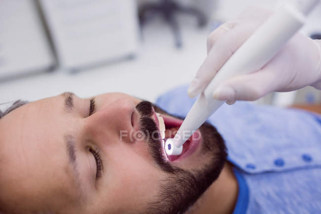 Gros plan du patient à bouche ouverte faisant l'objet d'un examen dentaire en clinique dentaire — Photo de stock