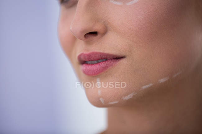 Porträt einer erwachsenen Frau mit Markierungen für kosmetische Behandlungen — Stockfoto