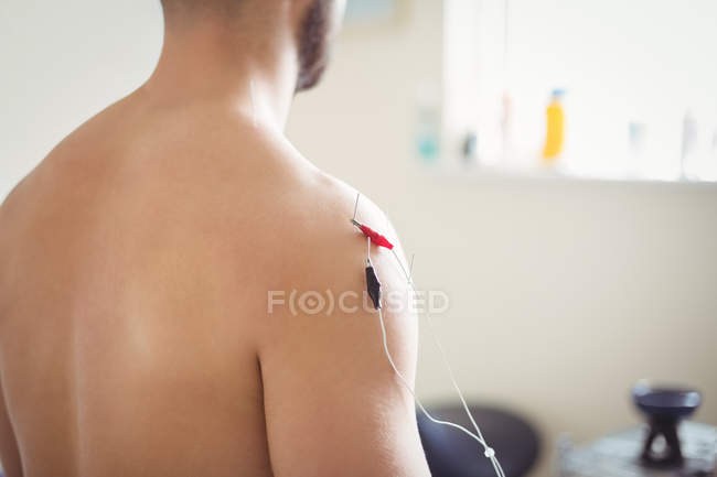 Primer plano del paciente masculino recibiendo agujas electro secas en el hombro - foto de stock