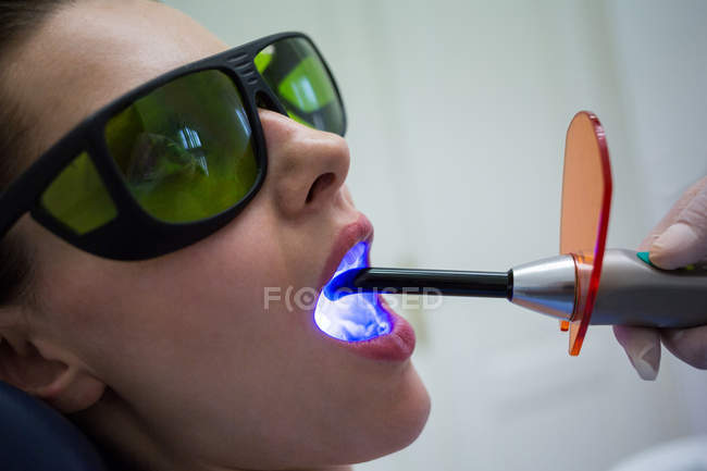 Dentista examinando los dientes del paciente con luz de curado dental en la clínica, primer plano - foto de stock