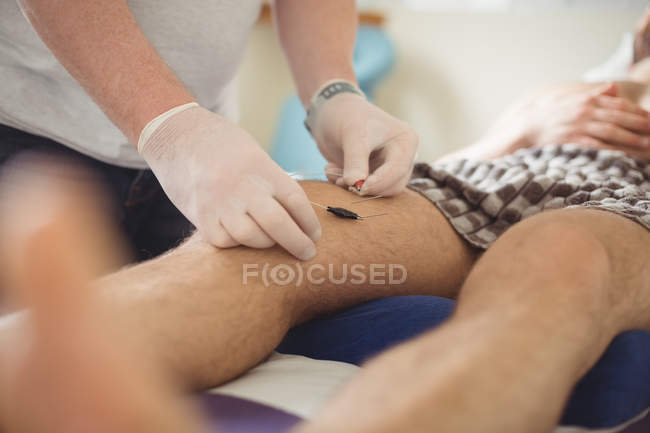 Physiothérapeute effectuant des aiguilles électro-sèches sur le genou du patient en clinique — Photo de stock