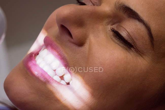Paziente di sesso femminile che riceve un trattamento leggero dei denti presso la clinica dentale, primo piano — Foto stock