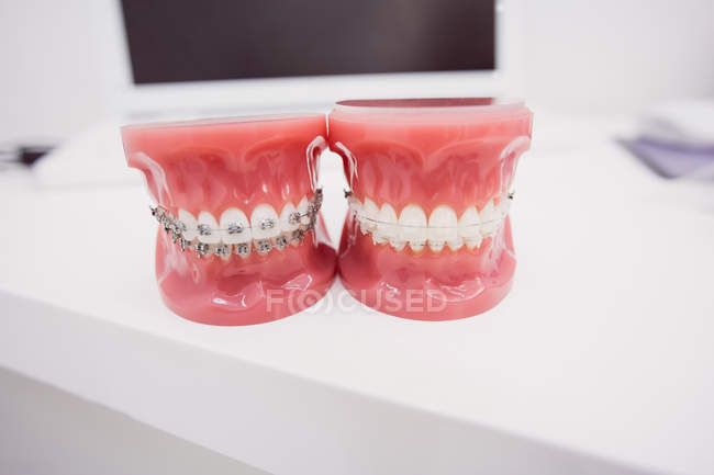 Close-up de modelos de dentes na clínica odontológica — Fotografia de Stock