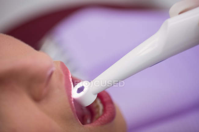 Nahaufnahme des Patienten mit offenem Mund, der sich in der Zahnklinik einer zahnärztlichen Untersuchung unterzieht — Stockfoto