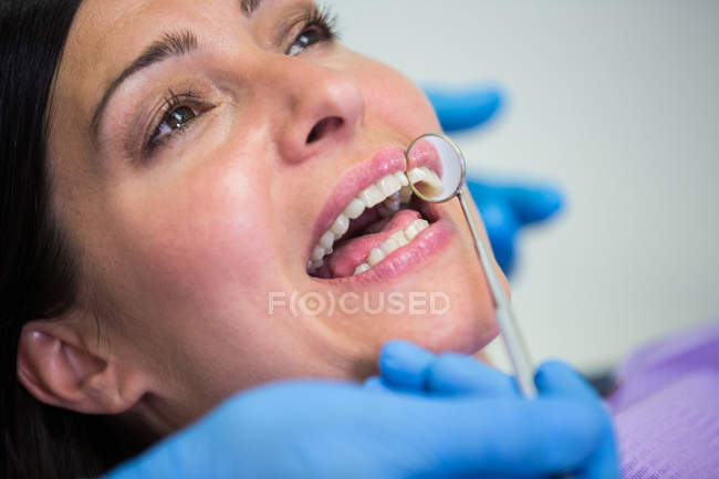 Primo piano del medico che esamina i denti delle pazienti con lo specchio della bocca — Foto stock