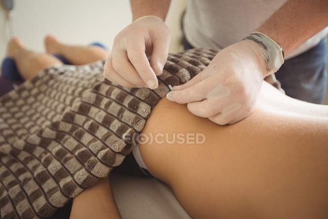 Close-up of physiotherapist inserting needle for dry needling on patient — Stock Photo
