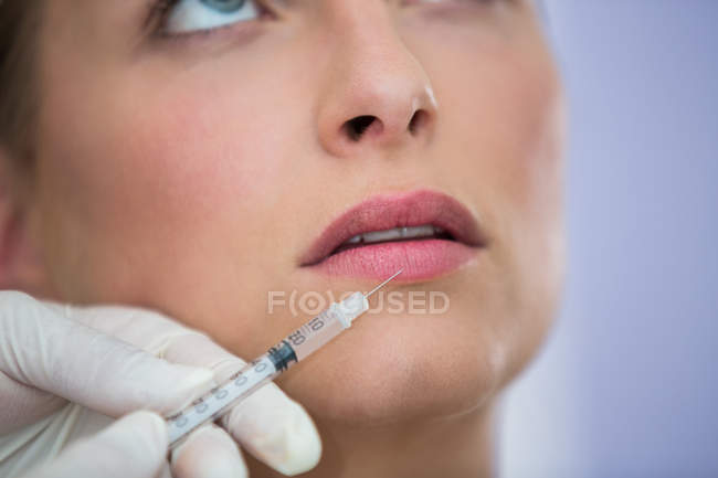 Закри жіночий пацієнта отримання ін'єкції ботокса на губах — стокове фото