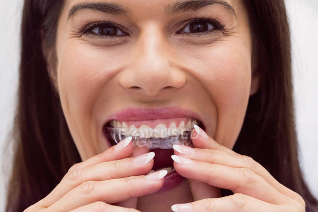 Жіночий пацієнт у брекетах у стоматологічній клініці — стокове фото