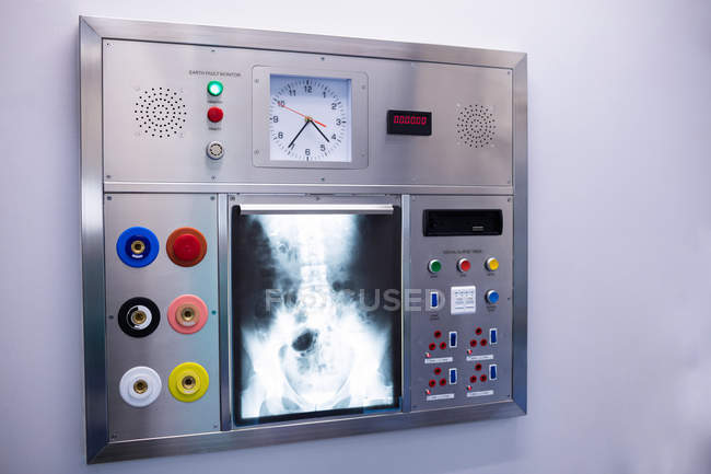 Primo piano della radiografia sulla scatola luminosa in ospedale — Foto stock