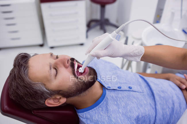 Крупним планом пацієнта з відкритим ротом, який проходить огляд зубів у стоматологічній клініці — стокове фото