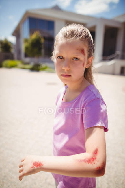 Portrait of injured girl on street — Stock Photo