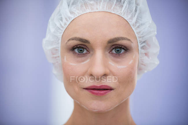 Retrato de mulher com marcas para tratamento cosmético usando tampa cirúrgica — Fotografia de Stock