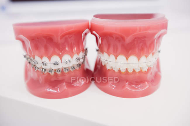 Gros plan sur les modèles de dents en clinique dentaire — Photo de stock
