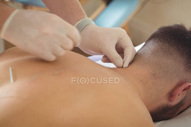Primer plano del fisioterapeuta realizando agujas secas en el cuello del paciente - foto de stock