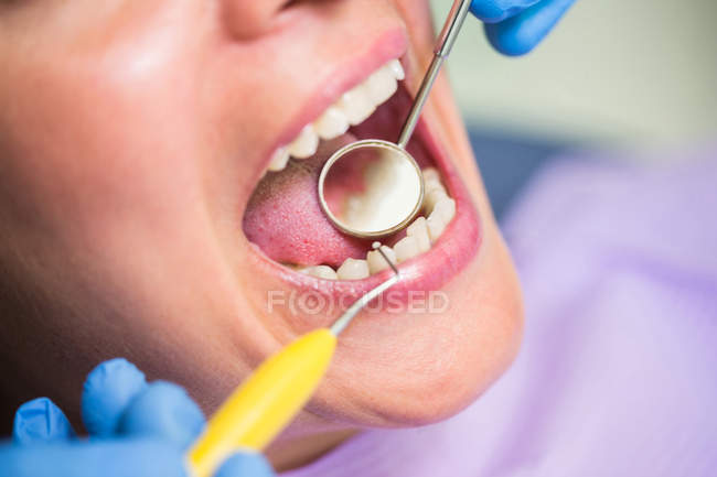 Крупный план стоматолога, осматривающего женские зубы пациента — стоковое фото