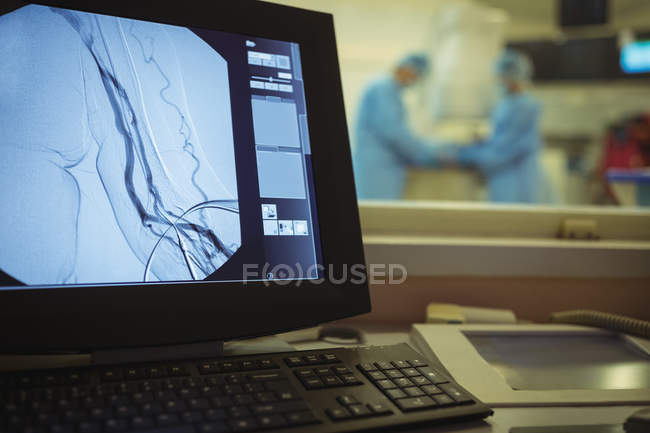 Nahaufnahme der Operation auf dem Computerbildschirm im Operationssaal — Stockfoto